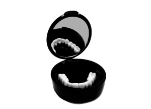 TruSmile Removable Veneer